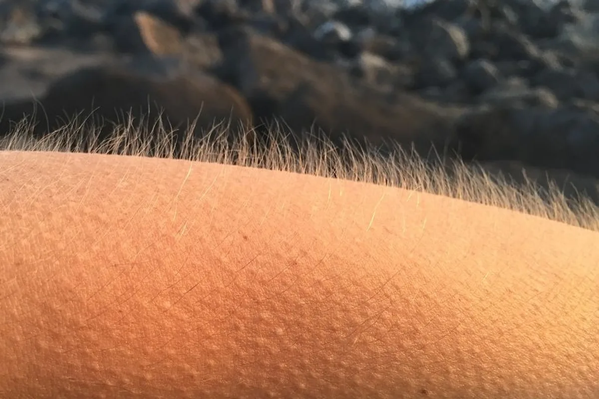 Close-up of goosebumps and raised hairs on a forearm